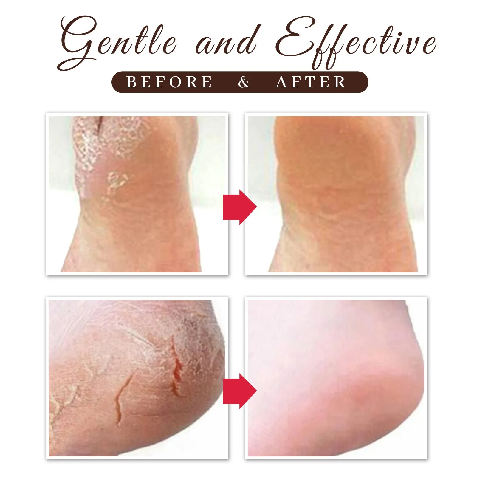 Horse Oil Foot Repair Cream For Dry And Peeling Feet